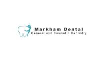 Dental Implants Markham